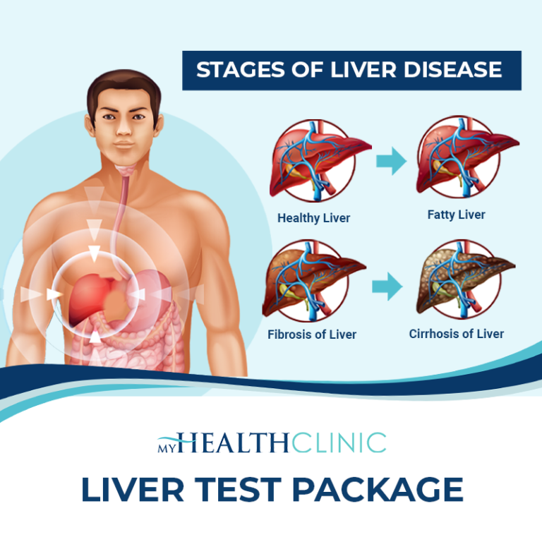 Liver Test Package | MyHealth Clinic